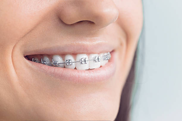 Best Veneers and Lumineers  in Davis Junction, IL